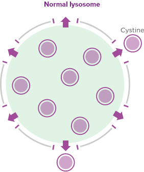 Illustration of normal lysosome showing cystine exiting the lysosome