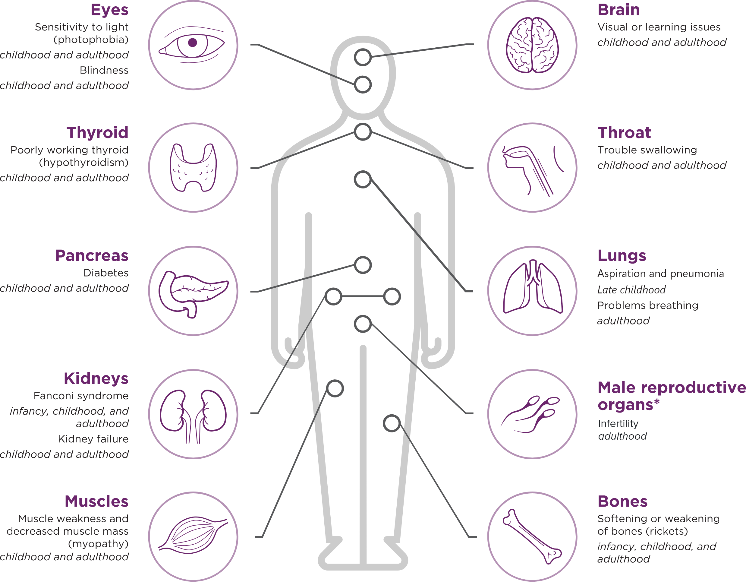 Diagram of the organs impacted from the accumulation of cystine in the eyes, brain, thyroid, throat, pancreas, lungs, kidneys, male reproductive organs, muscles, and bones
